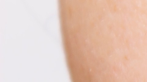 Los alimentos duros o altos en azúcar pueden generar daños severos en los dientes.