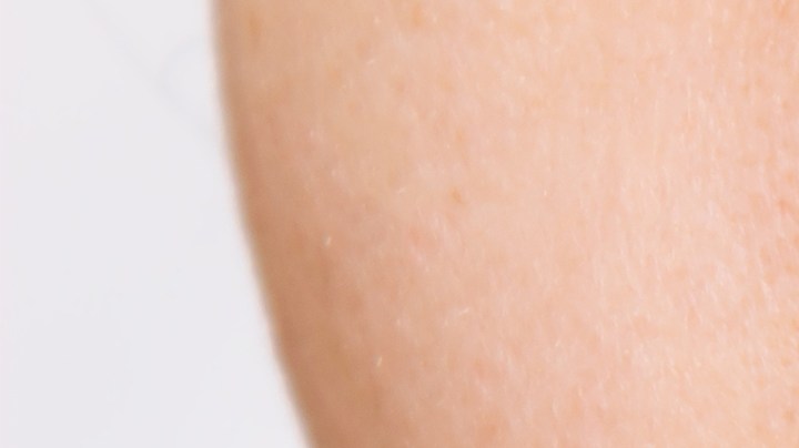 Los alimentos duros o altos en azúcar pueden generar daños severos en los dientes.