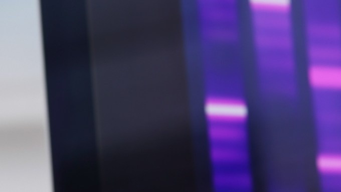 La diabetes es la principal causa de insuficiencia renal en Estados Unidos.