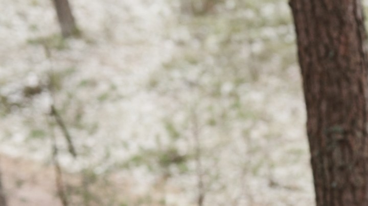 El entrenamiento de alta intensidad fortalece el corazón, pero el exceso sin supervisión puede provocar arritmias y cicatrices.