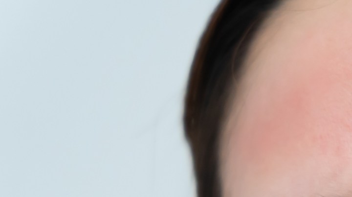 Los productos caducados provocan daños en la piel, labios y ojos