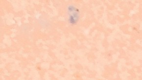 moscas de baño