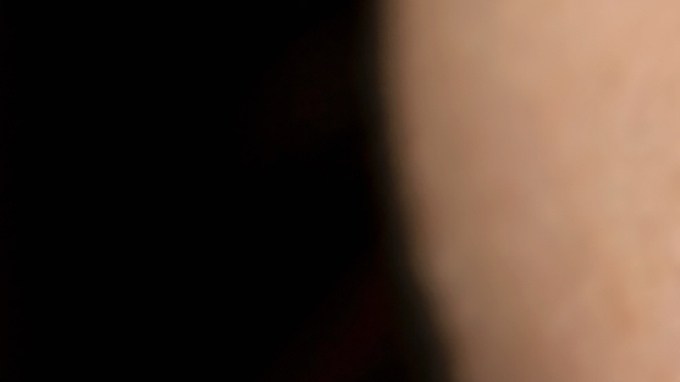 peeling químicos
